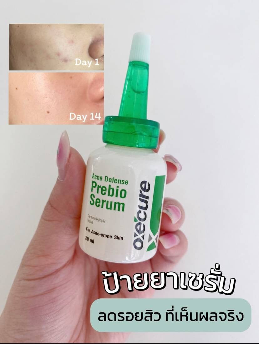 Oxe'Cure Acne Defense Prebio Serum