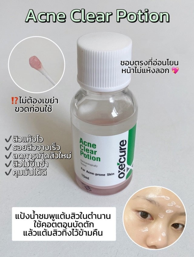 Oxe'Cure Acne Clear Potion